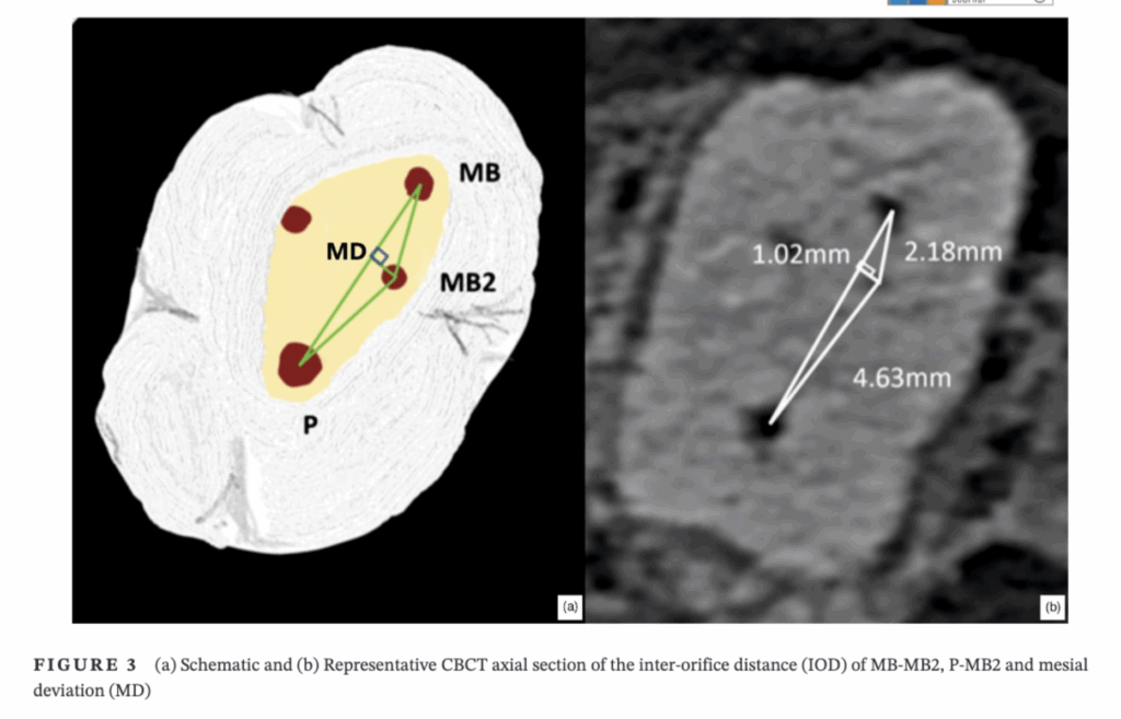 cortes axiais de molares com tomografia cone beam