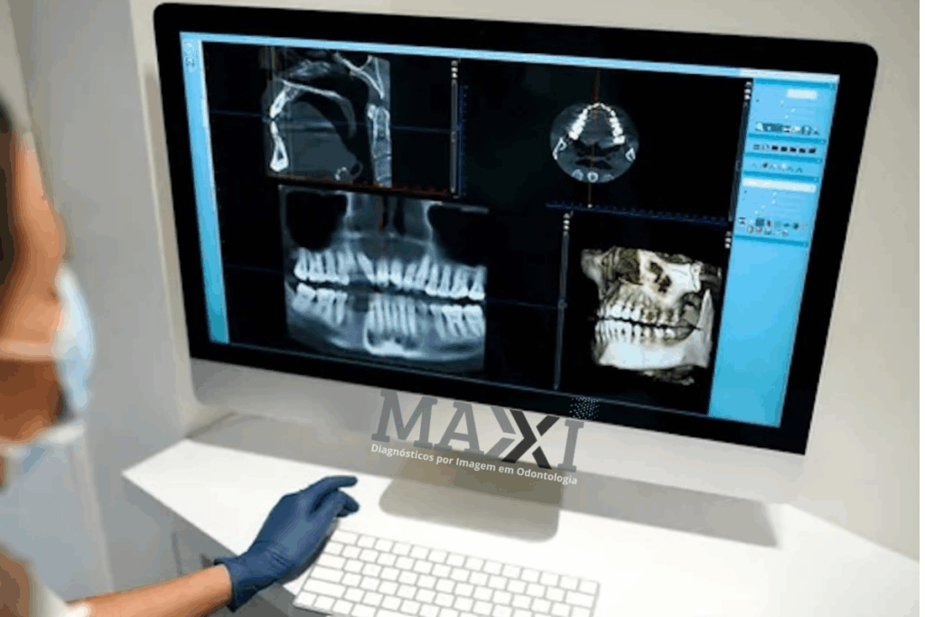 laudos a distancia para clinica de radiologia odontologica